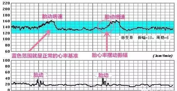 揭秘三个月胎儿心跳看男女，真相与误解的探讨