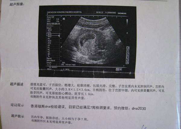 关于怀孕七个月通过B超检测胎儿性别的准确率分析