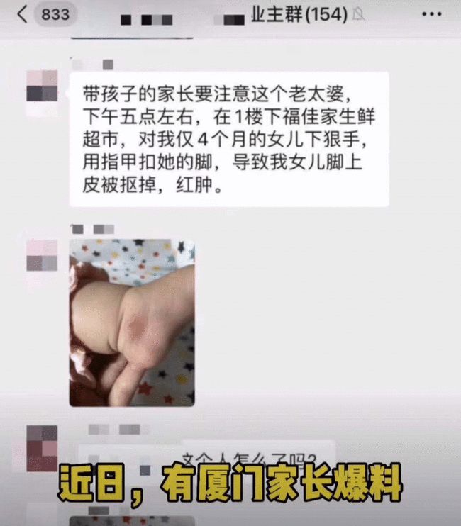 三个月宝宝惊现一根白发，探寻原因与应对策略