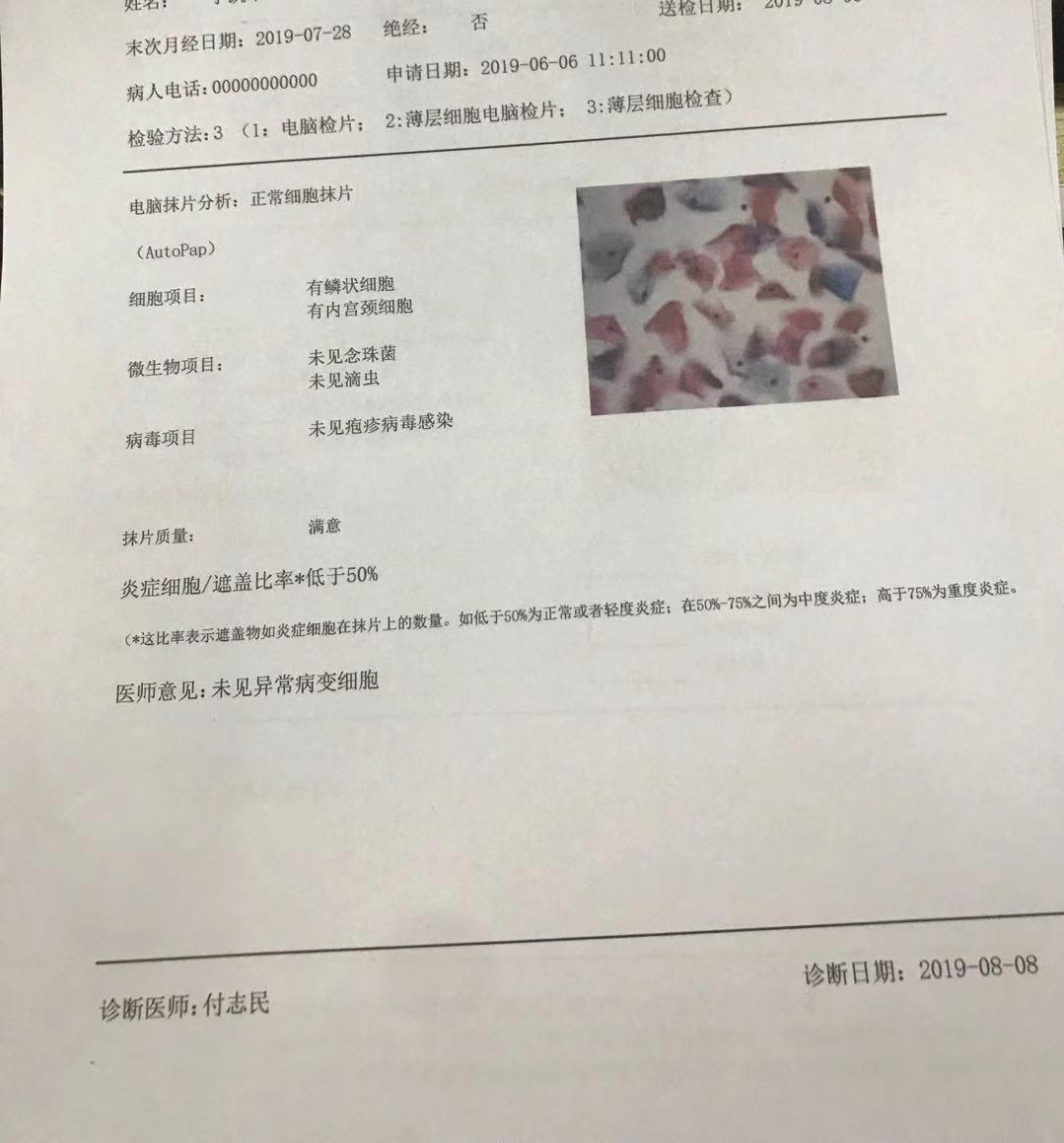 HIV检测阴性，四个月后的安心与理解