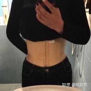 大腿吸脂半个月，腿不细——关于吸脂手术后的恢复与心理调适